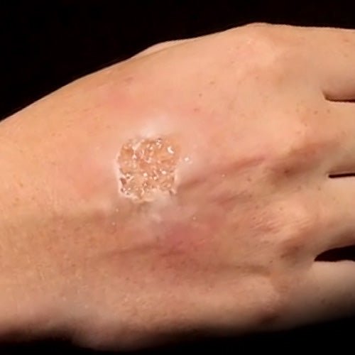 Blister Gel - 60ml